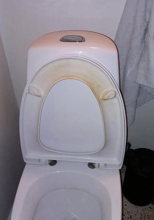 Tired of that stubborn yellow ring? Here’s how I finally got rid of it for good.