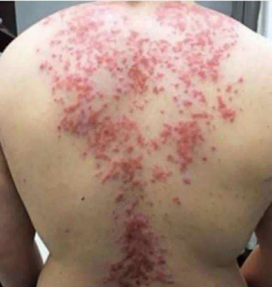 These are the effects of sleeping with the… See More